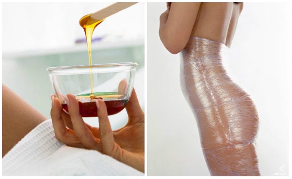 وزن میں کمی کے لئے جسم کی لپیٹ